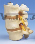 3 Lumbar Vertebrae, flexibly mounted